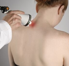 Laser therapy will help relieve inflammation and activate tissue regeneration in the neck