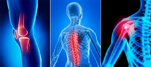 Joint pain in arthrosis
