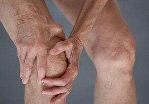 How does arthrosis of the knee joint manifest