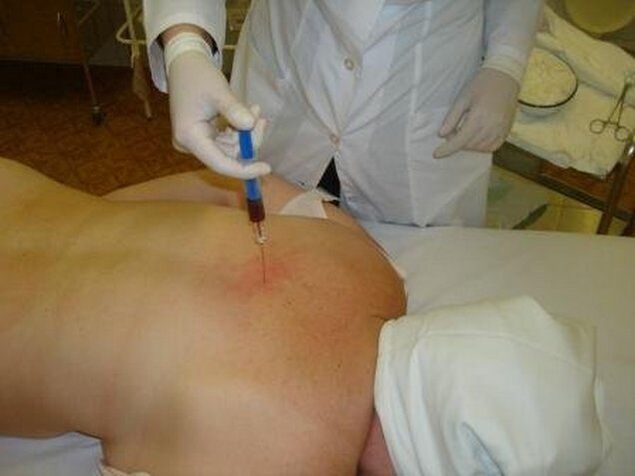 Injections treatment
